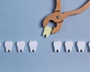 extraction dentaire indication et procédure