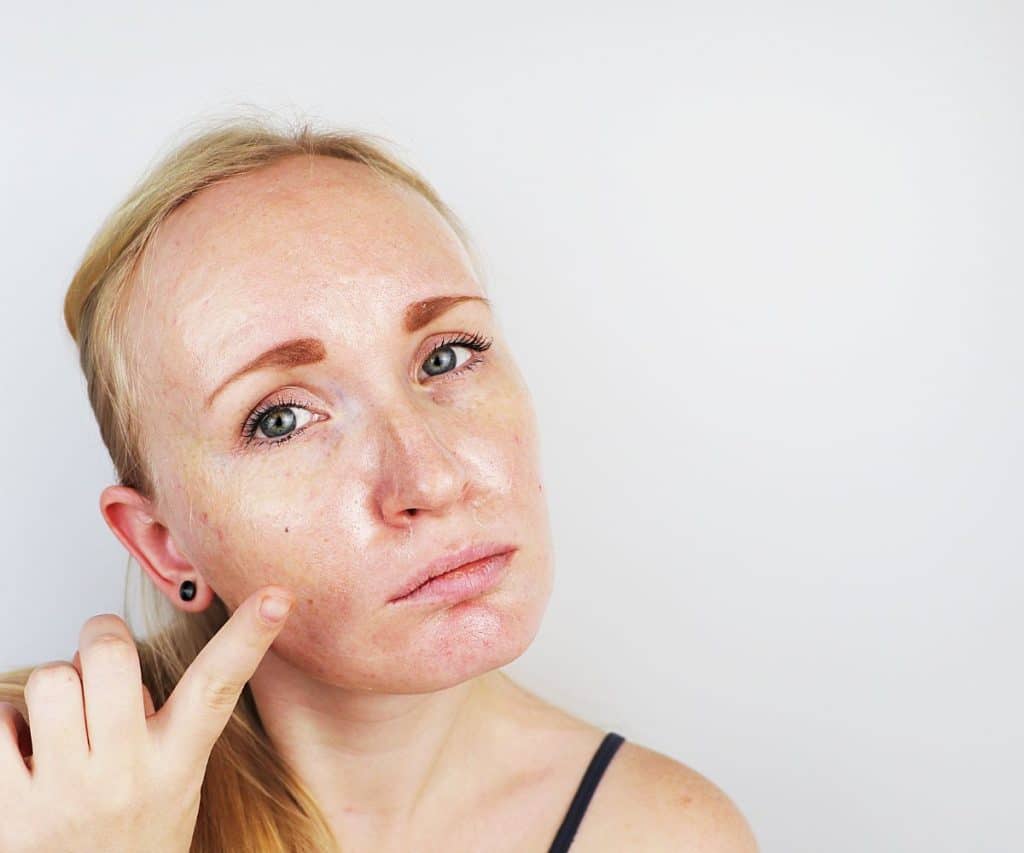 Comment Rendre Moins Gras Son Visage ? Astuces & Conseils
