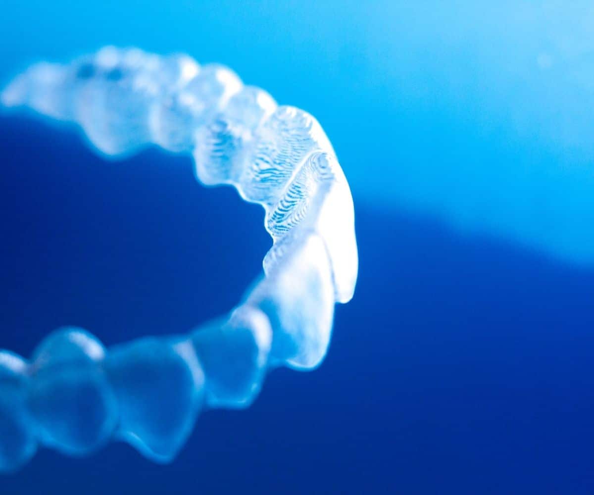 L'innovation en orthodontie : Les gouttières Invisalign et Spark